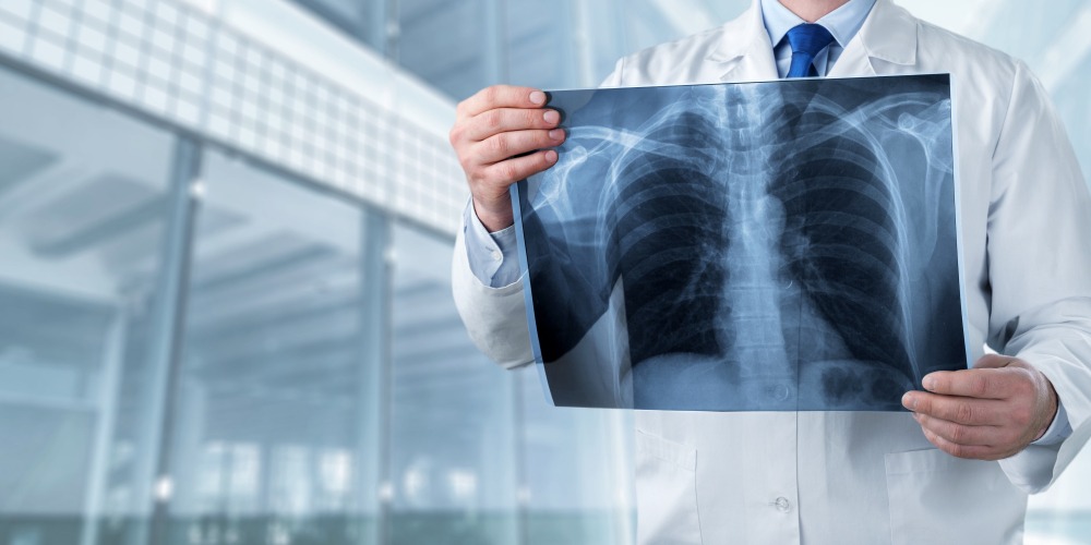 FRCR Part 1 (Radiology) 